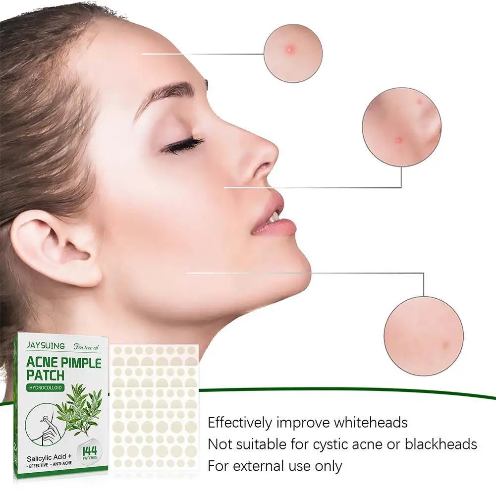 ClearSkin Hydrocolloid Acne Patches – Invisible & Healing